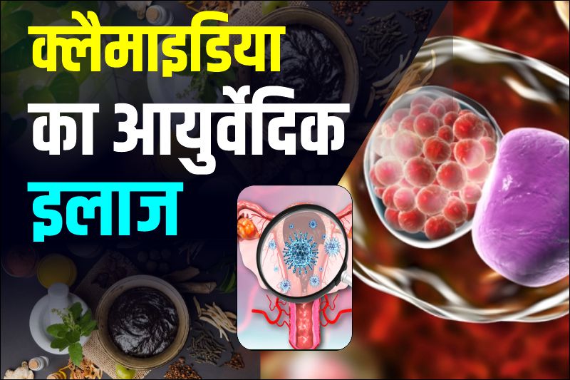 क्लैमाइडिया का आयुर्वेदिक इलाज दिल्ली